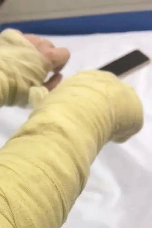 女主播称遭伪装快递包裹炸伤，湖南警方通报