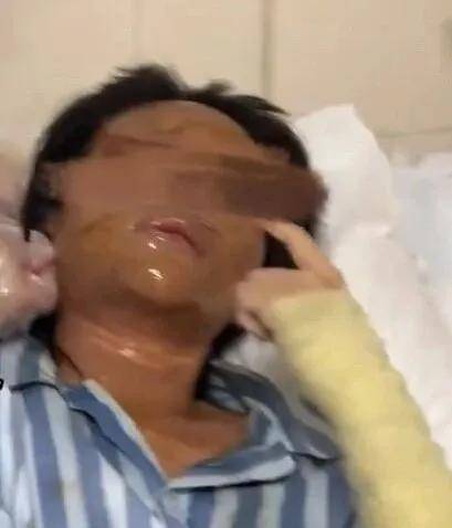 女主播称遭伪装快递包裹炸伤，湖南警方通报